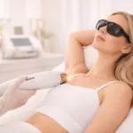 Laser haarentfernung achseln straubing